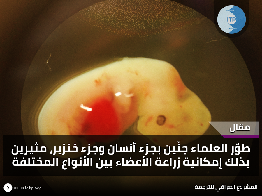 طوّر العلماء جنّين بجزء أنسان وجزء خنزير، مثيرين بذلك إمكانية زراعة الأعضاء بين الأنواع المختلفة طوّر العلماء جنّين بجزء أنسان وجزء خنزير، مثيرين بذلك إمكانية زراعة الأعضاء بين الأنواع المختلفة